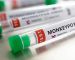 Monkeypox Spreads, Africa In Need Of Test Kits, Vaccines Monkeypox Spreads, Africa In Need Of Test Kits, Vaccines